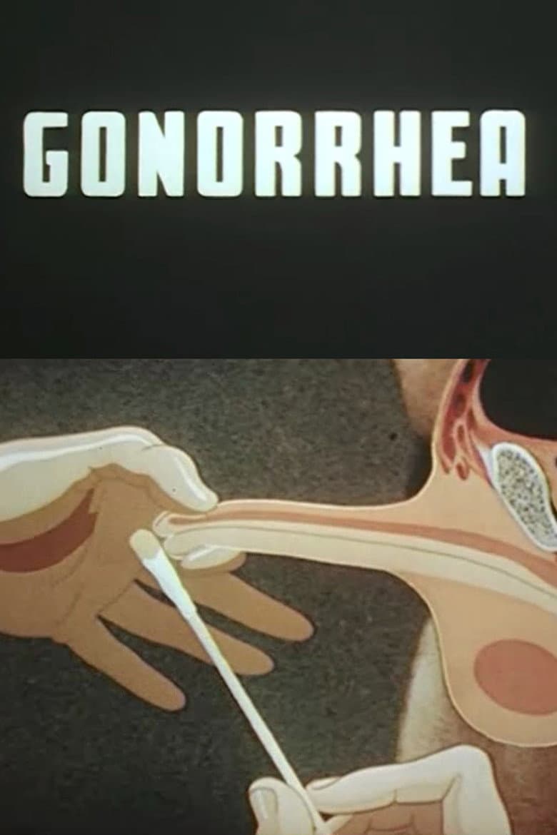 Gonorrhea — Rated on Seriez, track your watch history at seriez.app